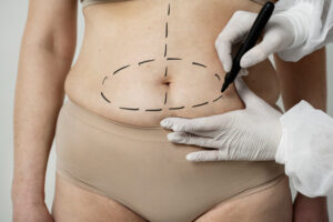 plastic surgery marketing